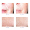 Close-up before and after photos showing skin texture and pigmentation changes over 12 weeks