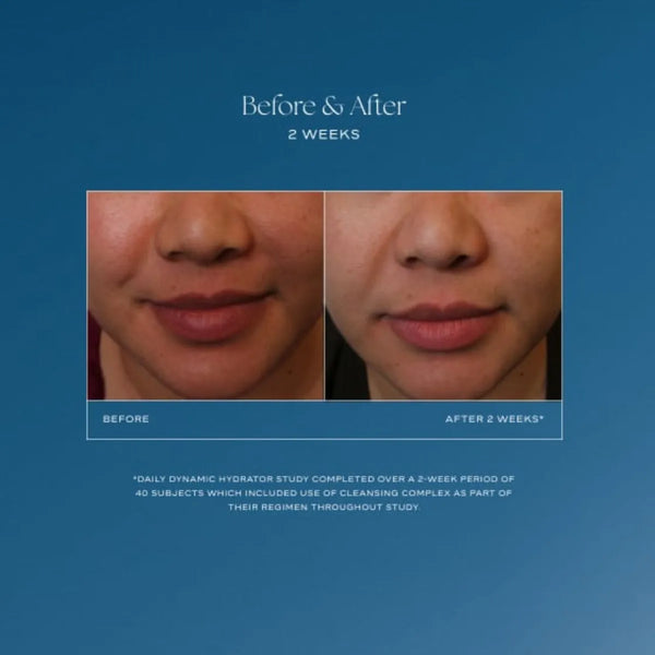 Side-by-side close-up of lower face before and after two weeks using Daily Dynamic Hydrator