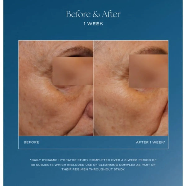 Side-by-side close-up of facial skin before and after one week using Daily Dynamic Hydrator