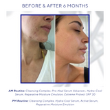 Active Serum