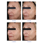 Youth Eye Complex 15g
