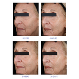 Youth Eye Complex 15g